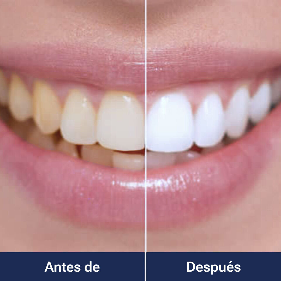 WellaWhite image