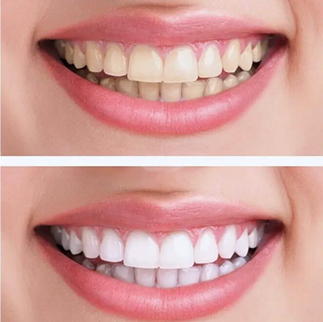 WellaWhite image