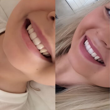 WellaWhite image