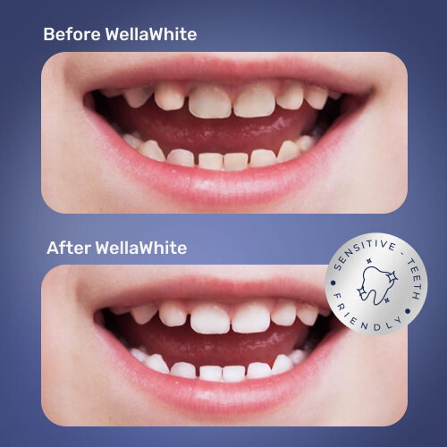 WellaWhite image