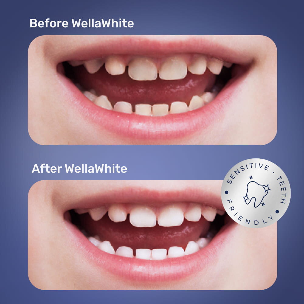 WellaWhite image