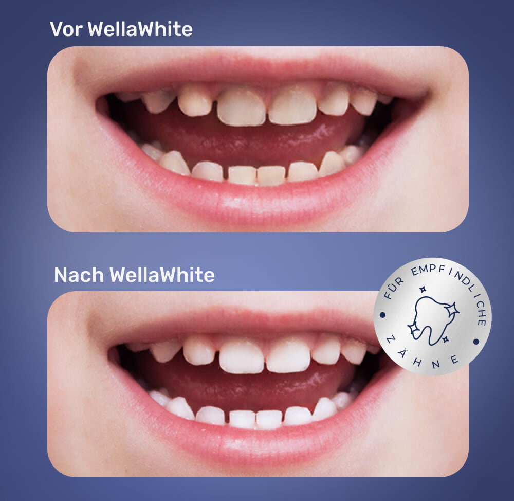 WellaWhite image