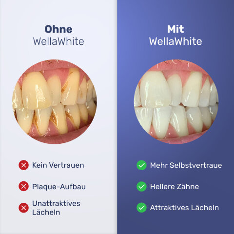 WellaWhite image